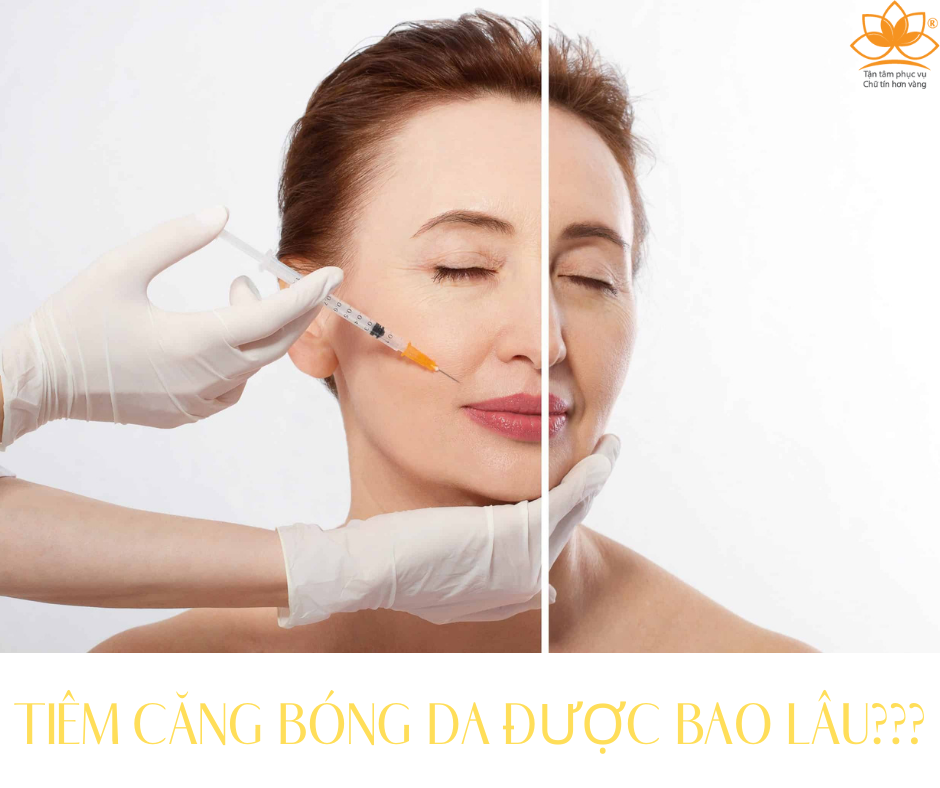 TIÊM CĂNG BÓNG DA DUY TRÌ ĐƯỢC BAO LÂU